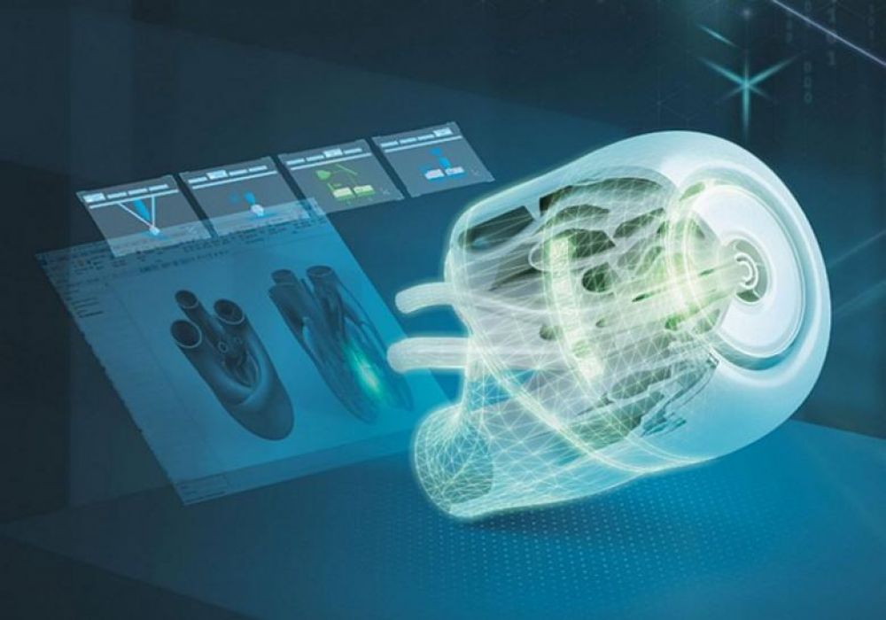 Siemens: Vernetzt Gesundheitsorganisationen mit Designern und 3D-Druckern für Produktion medizinischer Komponenten - WAiSCH